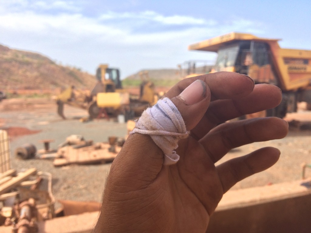 I Cut Myself&nbsp;Sometimes